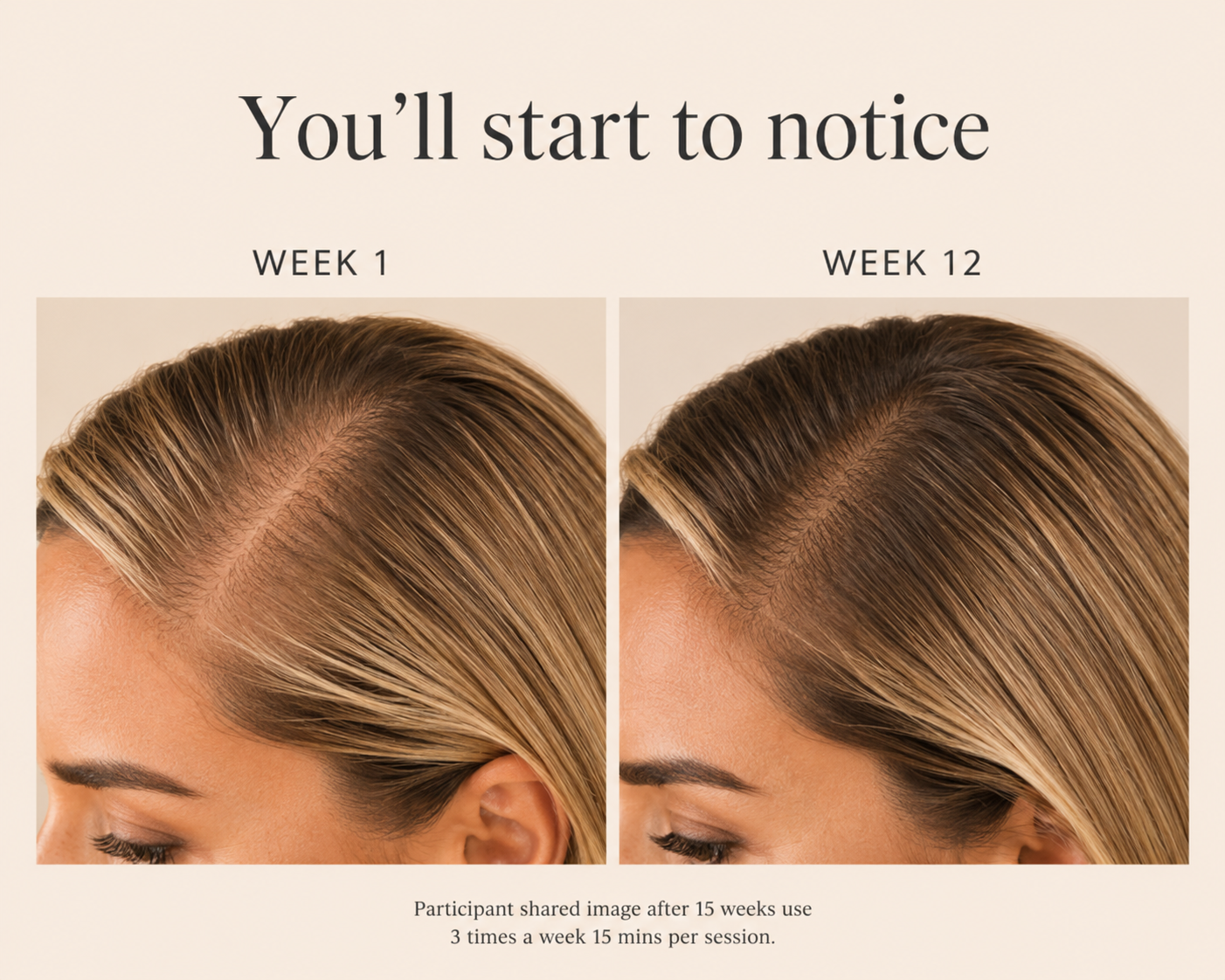 Hoku Lumina - Advanced Hair Therapy